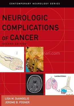 Neurologic Complications of Cancer: 73 (Contemporary Neurology Series)