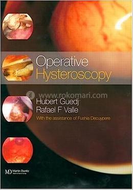 Operative Hysteroscopy