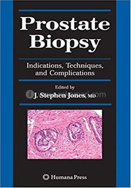 Prostate Biopsy