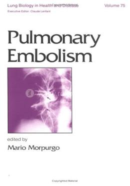 Pulmonary Embolism