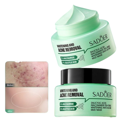 Sadoer Whitening Acne Removal Cream 50g Face Brightening image