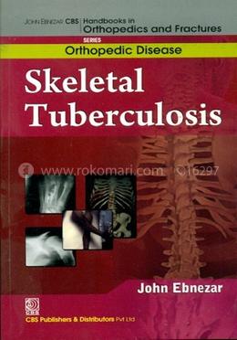 Skeletal Tuberculosis - (Handbooks in Orthopedics and Fractures Series, Vol. 33 : Orthopedic Diseases)
