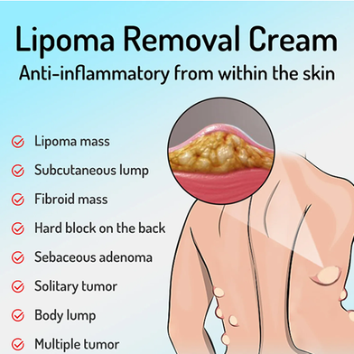 South Moon Lipoma Removal Cream-20g Slide 4