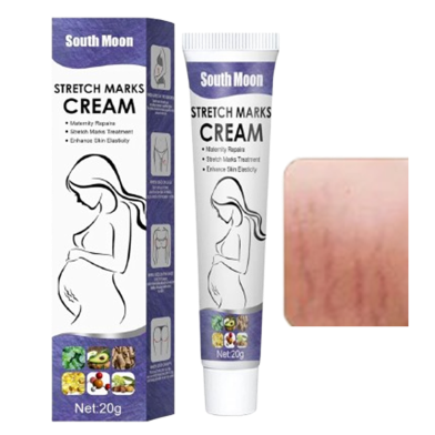 South Moon Stretch Marks Cream-20gm image