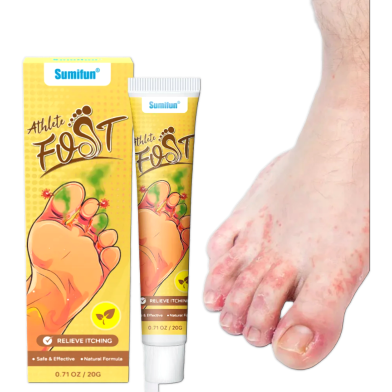 Sumifun Athlete Foot Relief Itching Cream 20gm image