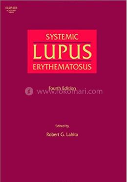 Systemic Lupus Erythematosus