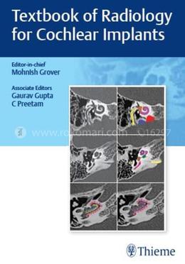 Textbook of Radiology for Cochlear Implants