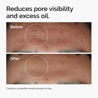 The Ordinary Niacinamide Serum 10percent plus Zinc1percent - 30ml - 38532 Slide 4
