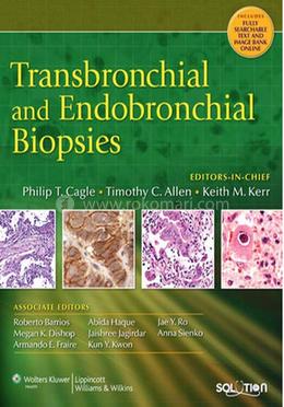 Transbronchial and Endobronchial Biopsies