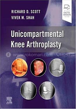 Unicompartmental Knee Arthroplasty