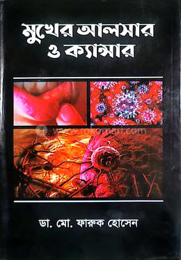 মুখের আলসার ও ক্যান্সার image