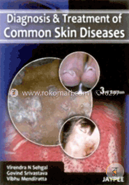 Diagnosis and Treatment of Common Skin Diseases 