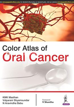 Color Atlas of Oral Cancer