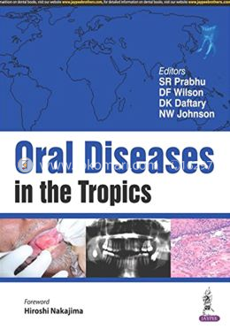 Oral Diseases in the Tropics