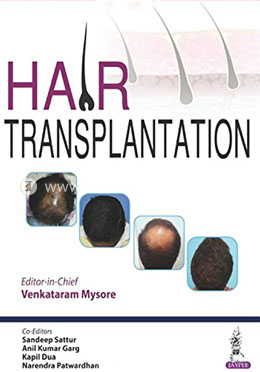 Hair Transplantation