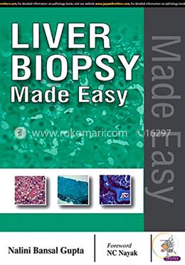 Liver Biopsy Made Easy