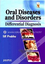 Oral Diseases and Disorders Differential Diagnosis (Paperback)