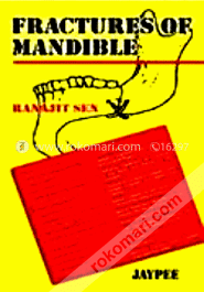 Fractures of Mandible (Paperback)