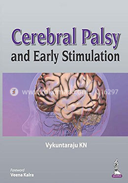 Cerebral Palsy and Early Stimulation