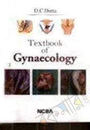 Textbook of Gynaecology 