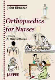 Orthopaedics for Nurses 