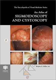 An Atlas of Sigmoidoscopy and Cystoscopy 