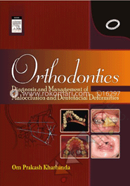 Orthodontics : Diagnosis And Management Of Malocclusion And Detofacial Deformities