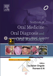Textbook Of Oral Medicine Oral Diagnosis and Oral Radiology 
