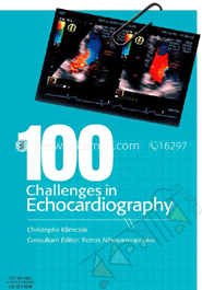 100 Challenges In Echocardiography