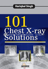 101 Chest X-Ray Solutions 