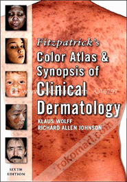 Fitzpatrick's Color Atlas and Synopsis of Clinical Dermatology (Paperback)
