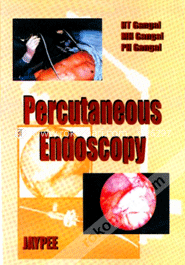 Percutaneous Endoscopy
