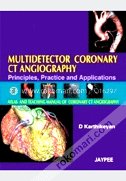 Multidetector Coronary CT Angiography 