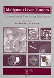 Malignant Liver Tumors 