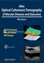 Atlas Optical Coherence Tomography of Macular Diseases and Glaucoma
