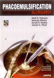 Phacoemulsification Surgery: A Practical Manual (with CD -Rom)