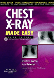 Chest X-Ray Made Easy