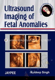 Ultrasound Imaging of Fetal Anomalies
