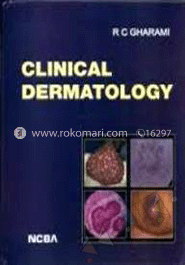 Clinical Dermatology 