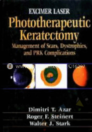 Excimer Laser Phototherapeutic Keratectomy: Phototherapeutic Keratectomy 