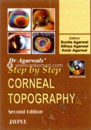 Step By Step Corneal Topography 