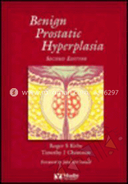 Benign Prostatic Hyperplasia