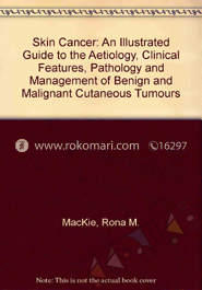 Skin Cancer: An Illustrated Guide To The Aetiology, Clinical Features, Pathology And Management Of Benign And Malignant Cutaneous Tumours