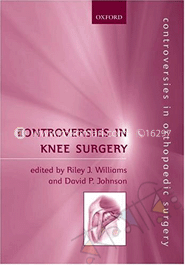 Controversies in Knee Surgery