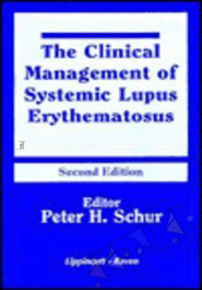 The Clinical Management Of Systemic Lupus Erythematosus