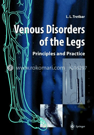 Venous Disorders of the Legs : Principles and Practice