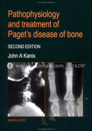 Pathophysiology and Treatment of Paget's Disease of Bone