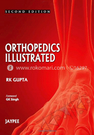 Orthopedics Illustrated