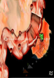 CT and Sonography of the Acute Abdomen
