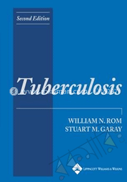 Tuberculosis
